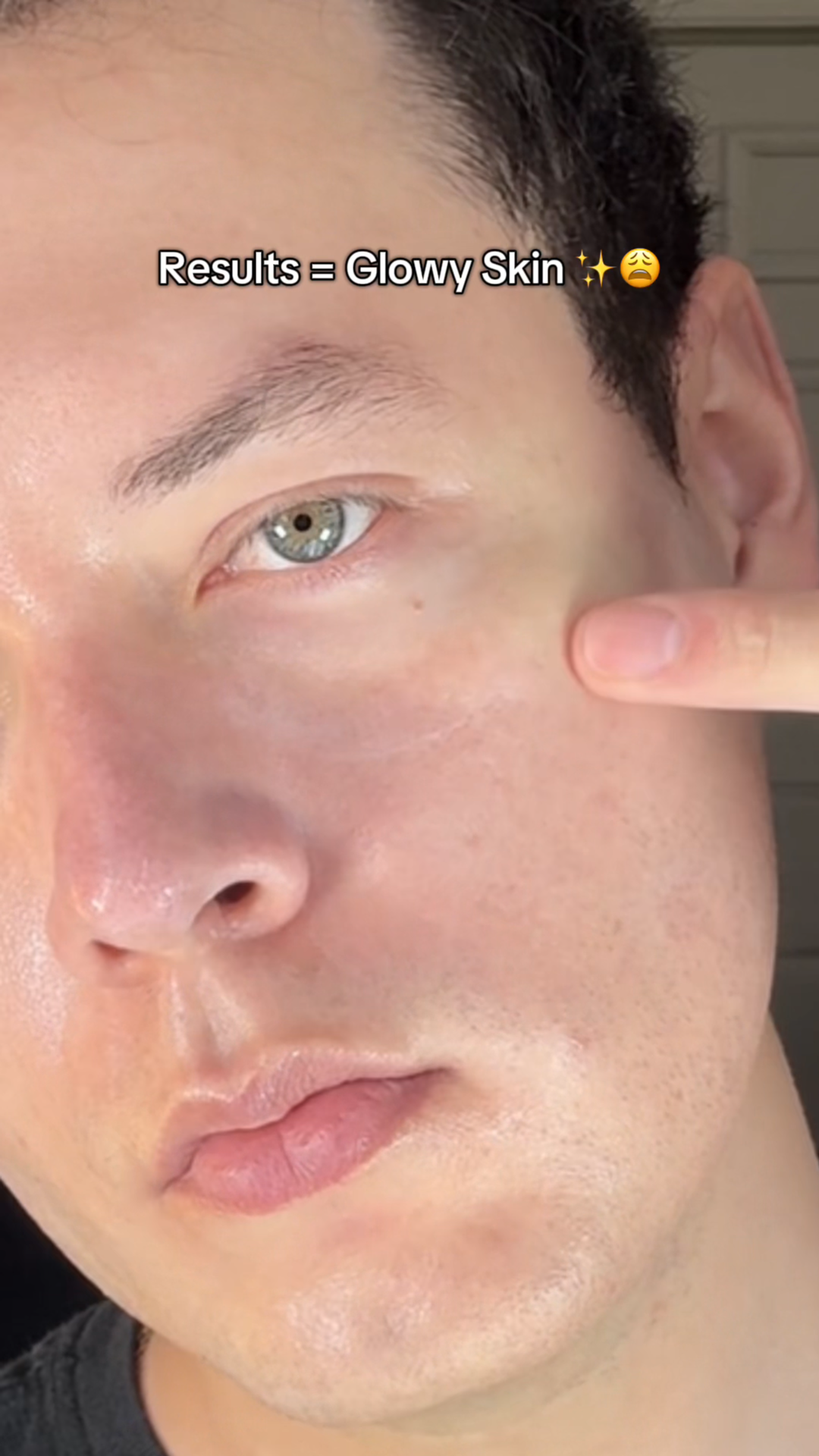 마데카솔 챌린지 비포 앤 애프터. 틱톡 @oskrrene