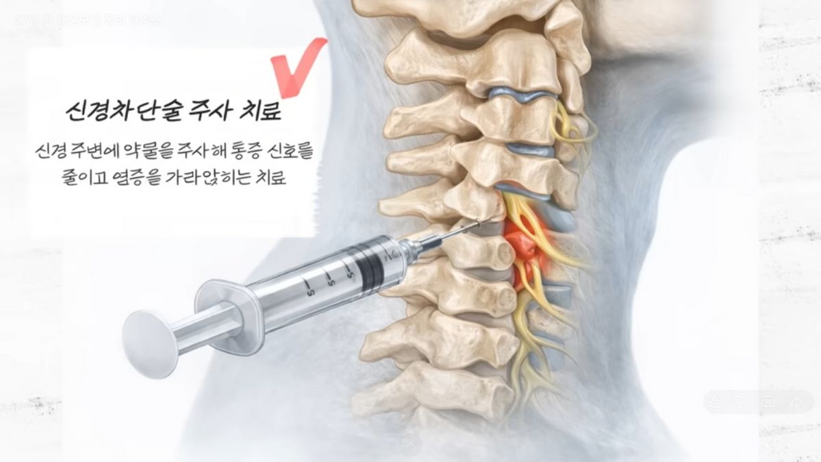한혜진 거북목 교정 | 출처 유튜브 <한혜진>